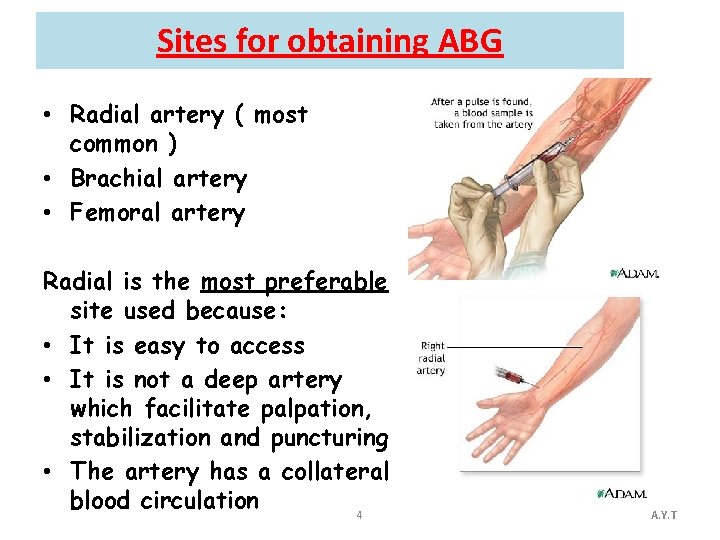 Sites for obtaining ABG • Radial artery ( most common ) • Brachial artery