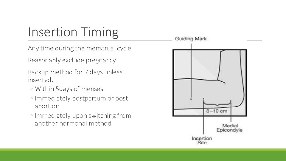 Insertion Timing Any time during the menstrual cycle Reasonably exclude pregnancy Backup method for