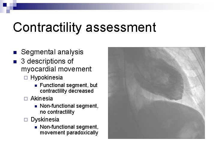 Contractility assessment n n Segmental analysis 3 descriptions of myocardial movement ¨ Hypokinesia n