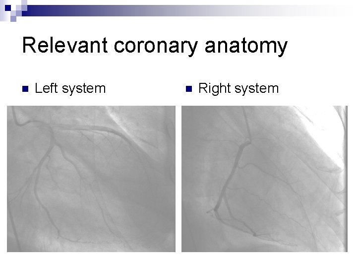 Relevant coronary anatomy n Left system n Right system 