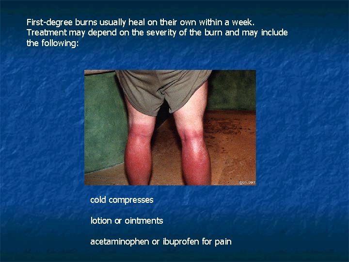 First-degree burns usually heal on their own within a week. Treatment may depend on