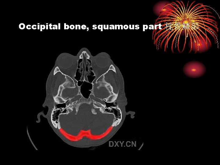 Occipital bone, squamous part 枕骨鳞部 