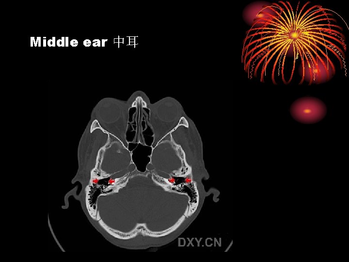 Middle ear 中耳 
