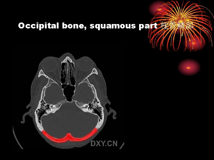 Occipital bone, squamous part 枕骨鳞部 