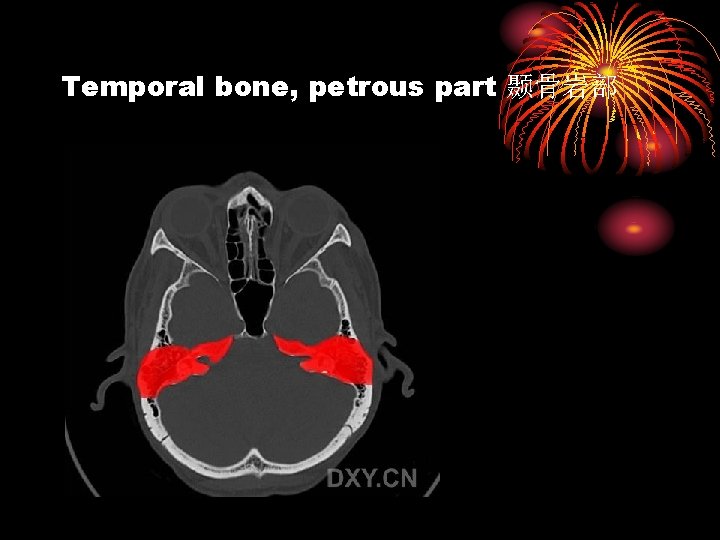 Temporal bone, petrous part 颞骨岩部 