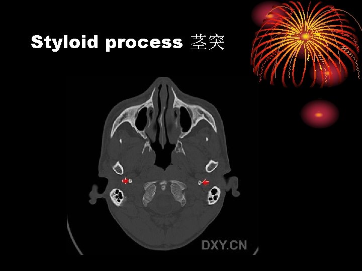 Styloid process 茎突 