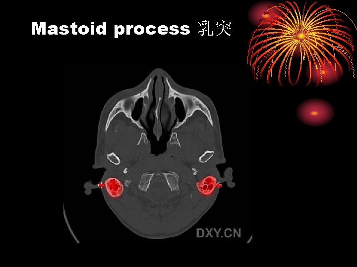 Mastoid process 乳突 