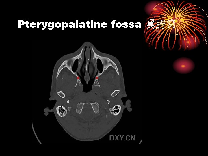 Pterygopalatine fossa 翼腭窝 