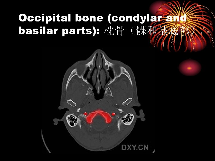 Occipital bone (condylar and basilar parts): 枕骨（髁和基底部） 