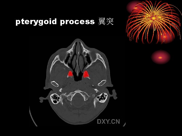 pterygoid process 翼突 