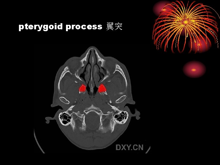 pterygoid process 翼突 