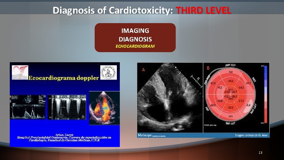 Diagnosis of Cardiotoxicity: THIRD LEVEL IMAGING DIAGNOSIS ECHOCARDIOGRAM 13 