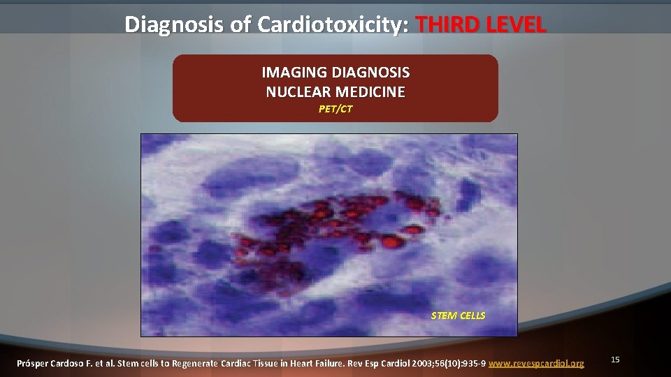 Diagnosis of Cardiotoxicity: THIRD LEVEL IMAGING DIAGNOSIS NUCLEAR MEDICINE PET/CT STEM CELLS Prósper Cardoso