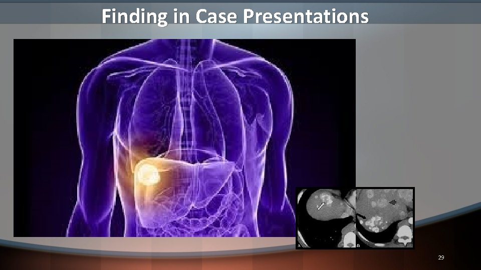 Finding in Case Presentations 29 