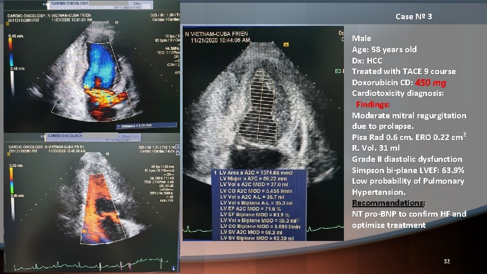 Case Nº 3 Male Age: 58 years old Dx: HCC Treated with TACE 9