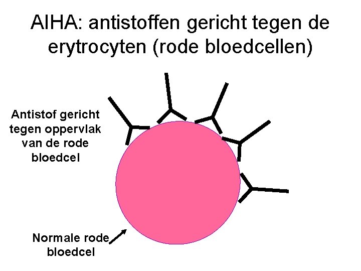 AIHA: antistoffen gericht tegen de erytrocyten (rode bloedcellen) Antistof gericht tegen oppervlak van de