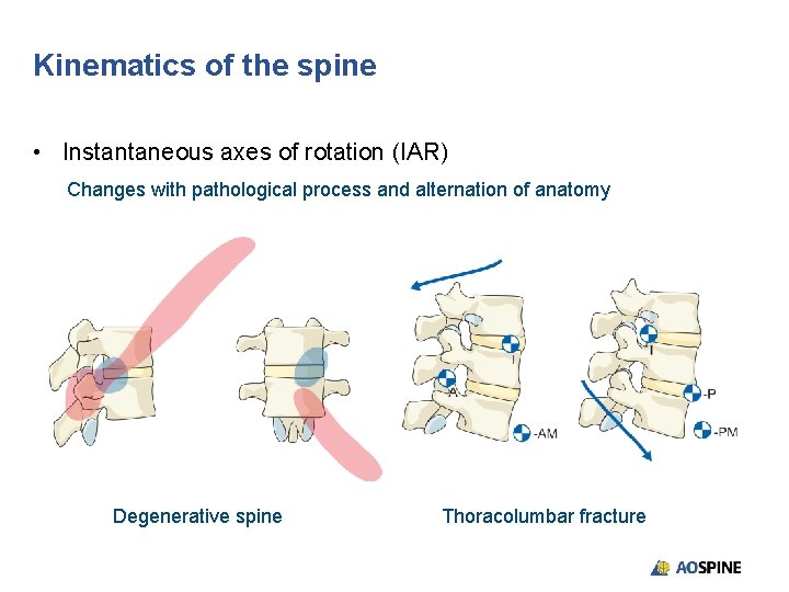 Kinematics of the spine • Instantaneous axes of rotation (IAR) Changes with pathological process