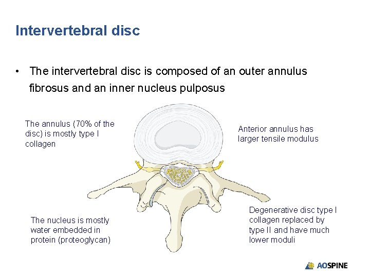 Intervertebral disc • The intervertebral disc is composed of an outer annulus fibrosus and
