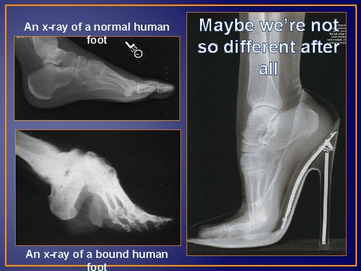 An x-ray of a normal human foot An x-ray of a bound human Maybe