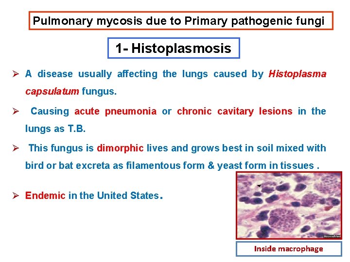 Pulmonary mycosis due to Primary pathogenic fungi 1 - Histoplasmosis Ø A disease usually Pulmonary mycosis due to Primary pathogenic fungi 1 - Histoplasmosis Ø A disease usually