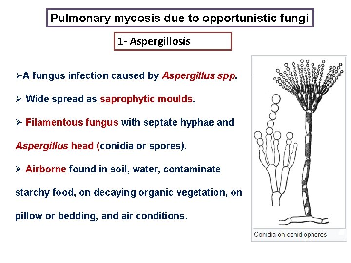 Pulmonary mycosis due to opportunistic fungi 1 - Aspergillosis ØA fungus infection caused by Pulmonary mycosis due to opportunistic fungi 1 - Aspergillosis ØA fungus infection caused by