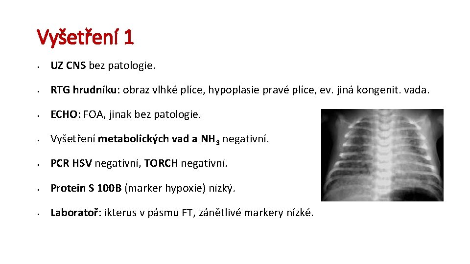 Vyšetření 1 § UZ CNS bez patologie. § RTG hrudníku: obraz vlhké plíce, hypoplasie