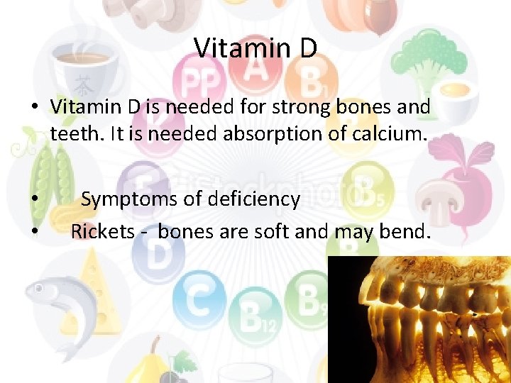 Vitamin D • Vitamin D is needed for strong bones and teeth. It is