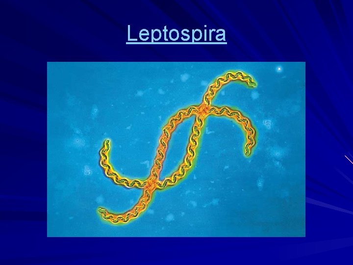 Leptospira 