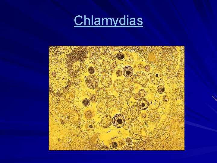 Chlamydias 