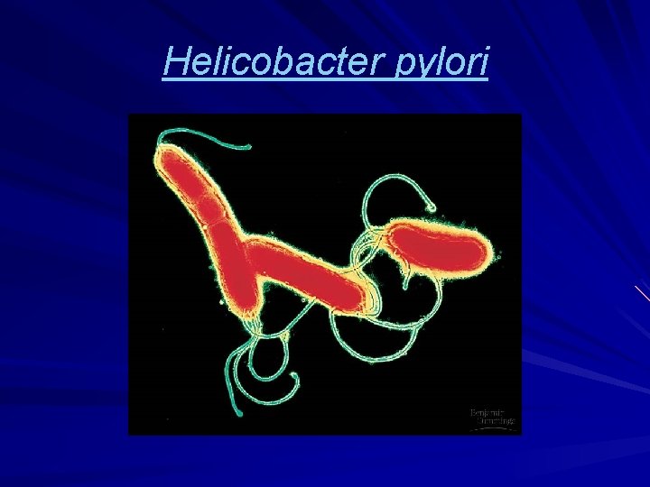 Helicobacter pylori 