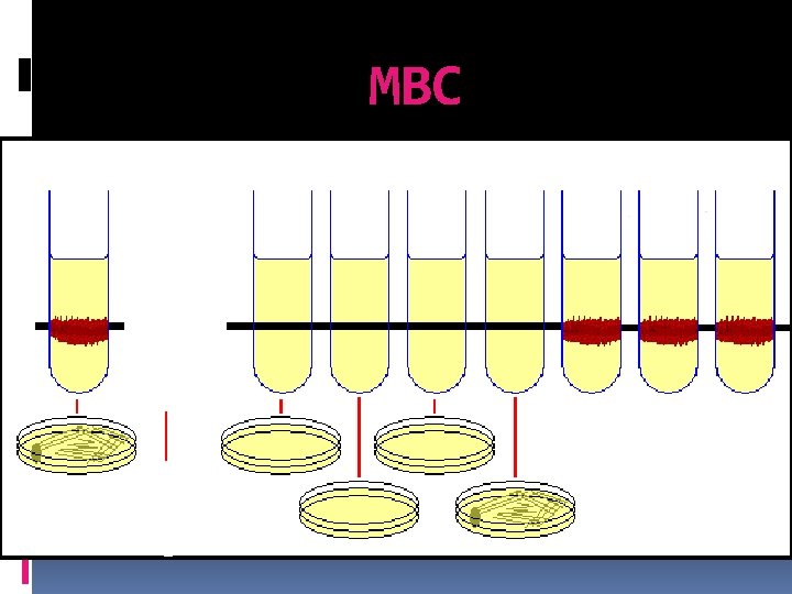 MBC 