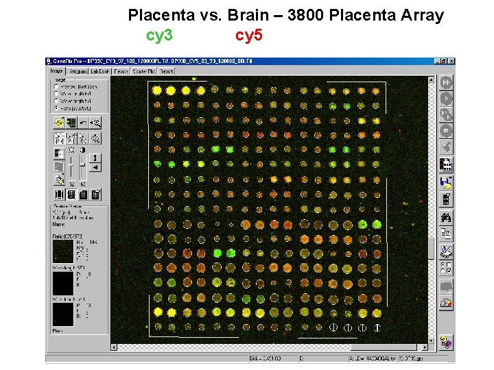 Placenta vs. Brain – 3800 Placenta Array cy 3 cy 5 