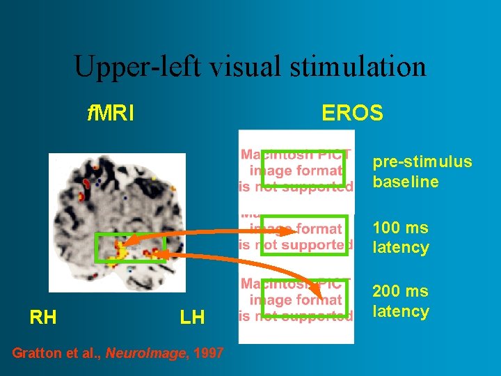 Upper-left visual stimulation f. MRI EROS pre-stimulus baseline 100 ms latency RH LH Gratton