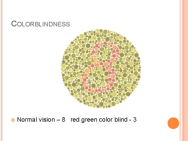 COLORBLINDNESS Normal vision – 8 red green color blind - 3 