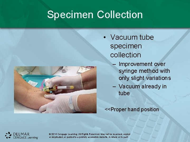 Specimen Collection • Vacuum tube specimen collection – Improvement over syringe method with only