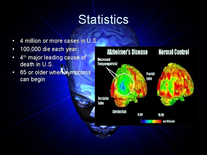 Statistics • 4 million or more cases in U. S. • 100, 000 die