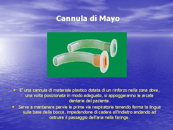 Cannula di Mayo • E' una cannula di materiale plastico dotata di un rinforzo