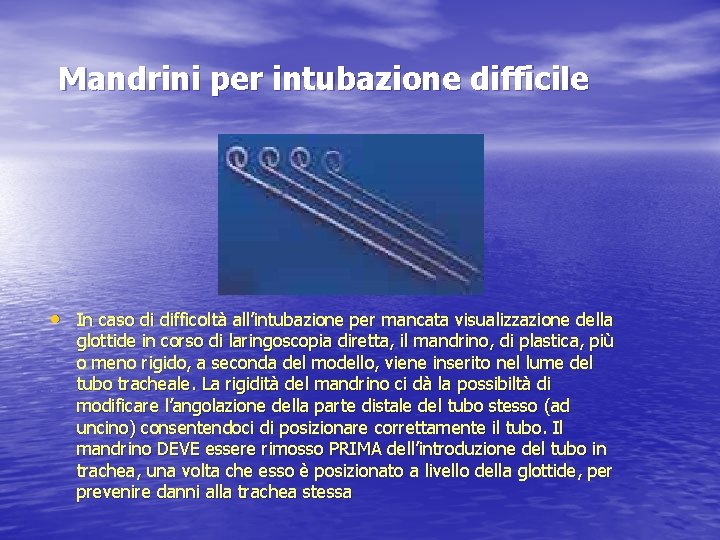 Mandrini per intubazione difficile • In caso di difficoltà all’intubazione per mancata visualizzazione della