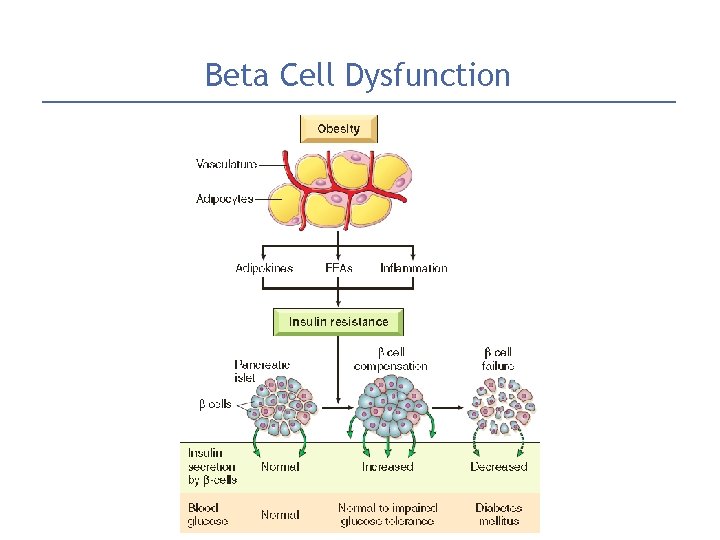 Beta Cell Dysfunction 