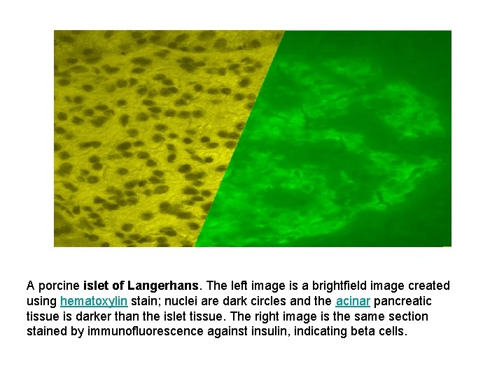 A porcine islet of Langerhans. The left image is a brightfield image created using