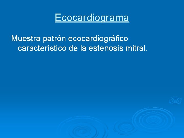 Ecocardiograma Muestra patrón ecocardiográfico característico de la estenosis mitral. 