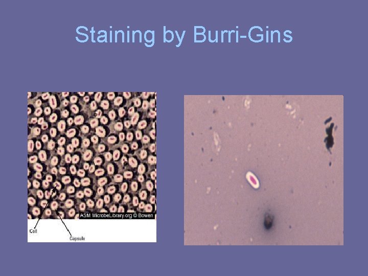 Staining by Burri-Gins Staining by Burri-Gins