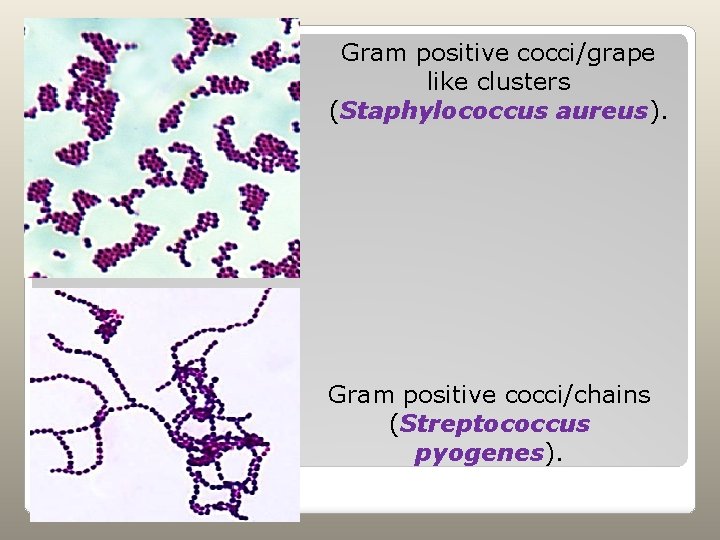 Gram positive cocci/grape like clusters (Staphylococcus aureus). Gram positive cocci/chains (Streptococcus pyogenes). 