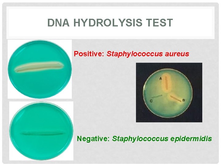 DNA HYDROLYSIS TEST Positive: Staphylococcus aureus Negative: Staphylococcus epidermidis 