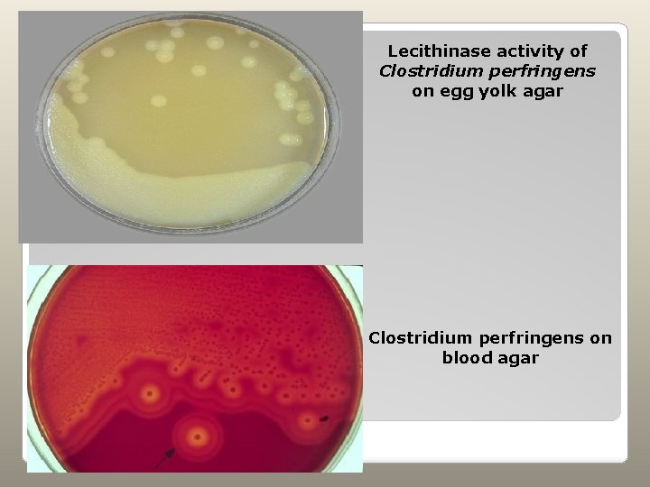Lecithinase activity of Clostridium perfringens on egg yolk agar Clostridium perfringens on blood agar