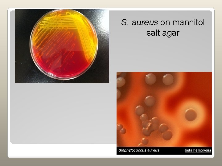 S. aureus on mannitol salt agar 