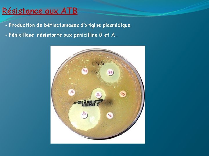 Résistance aux ATB - Production de bétlactamases d’origine plasmidique. - Pénicillase résistante aux pénicilline