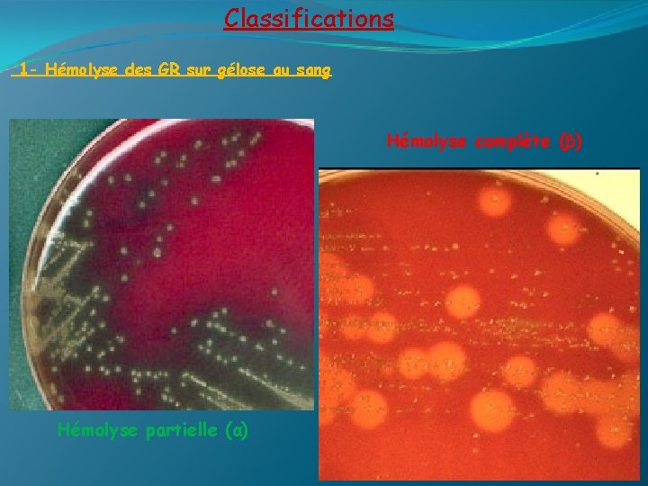 Classifications 1 - Hémolyse des GR sur gélose au sang Hémolyse complète (β) Hémolyse