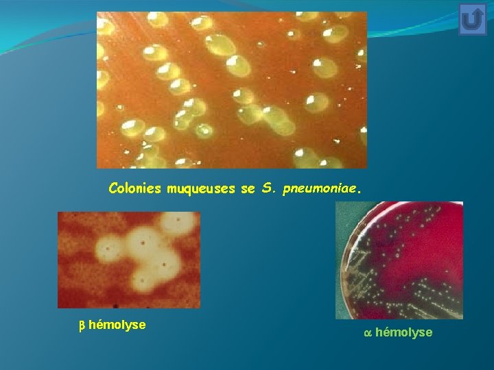 Colonies muqueuses se S. pneumoniae. hémolyse 