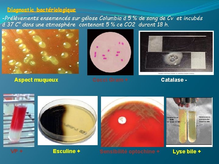 Diagnostic bactériologique -Prélèvements ensemencés sur gélose Columbia à 5 ℅ de sang de Cv